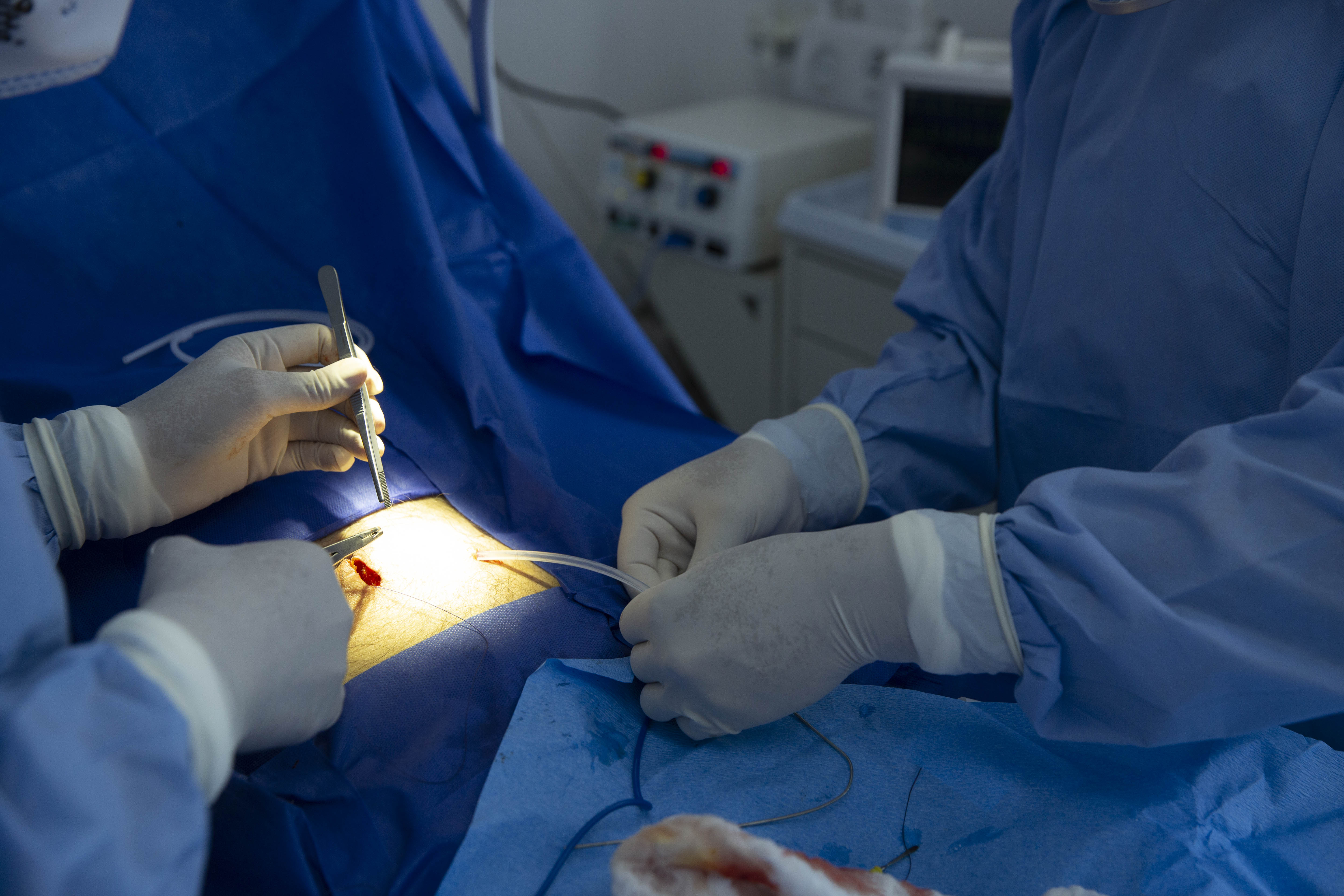 Perioperative and Intraoperative Management